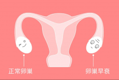 卵巢早衰有哪些表现？卵巢早衰的信号有哪些？