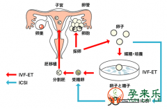 试管婴儿成功率因素取决于什么？