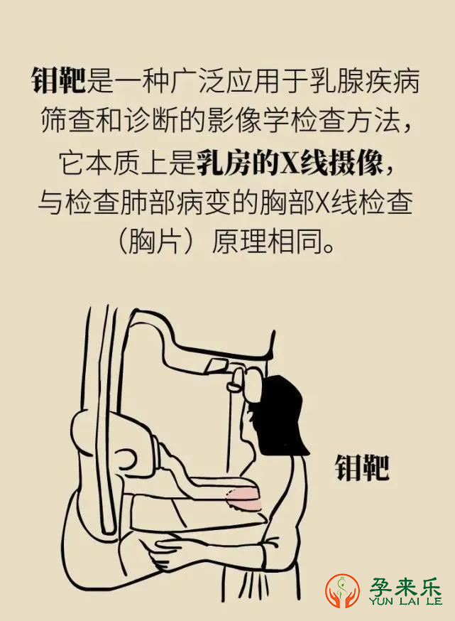 女性乳腺钼靶检查的重要性