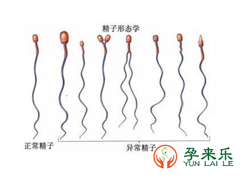 影响男性精子的绊脚石有哪些？