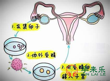 试管婴儿和自然受孕的宝宝一样吗？