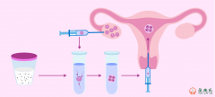 提高试管婴儿成功率有哪些方法？提高试管婴儿