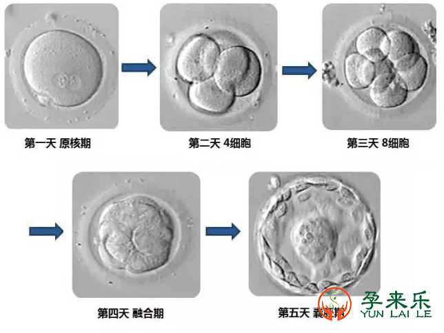 2023年马来西亚第三代试管费用是多少？