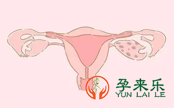 什么是卵巢早衰？试管婴儿会导致卵巢早衰吗？