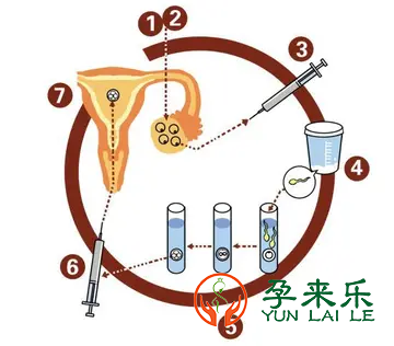 喜孕多告诉你：做试管婴儿胚胎移植前后有哪些误区？