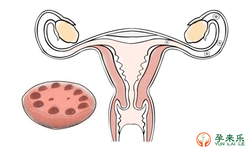 卵巢为什么会早衰？还有生育的机会吗？