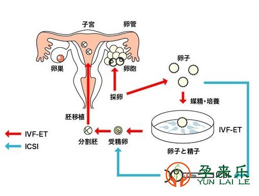 在国内选择第三代试管生龙凤胎大概需要多少钱