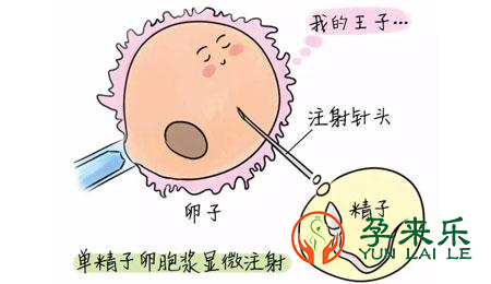 一代二代试管的区别?适应人群有什么不同？