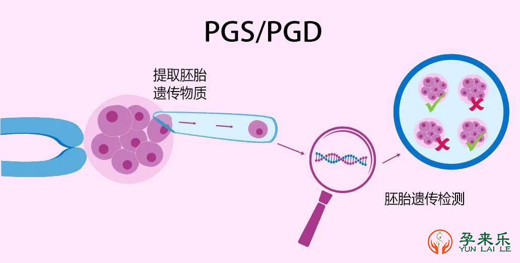 高龄女性试管婴儿:挑战生育难题的新尝试