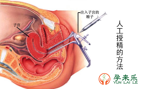 男性不育，是现代男性难以承受的痛