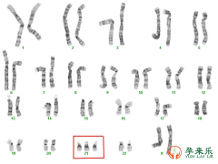什么是染色体异常？染色体异常可以做三代试管