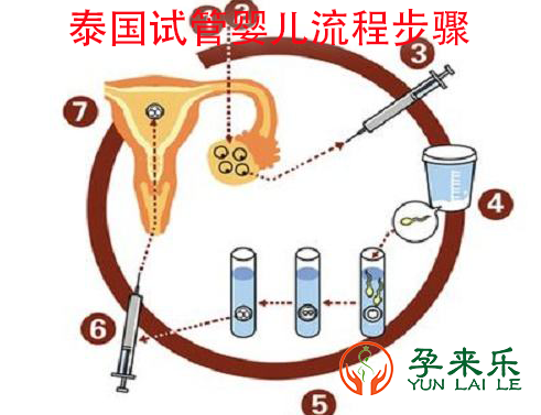 从去泰国做试管婴儿的经历总结?泰国做试管注意事项?