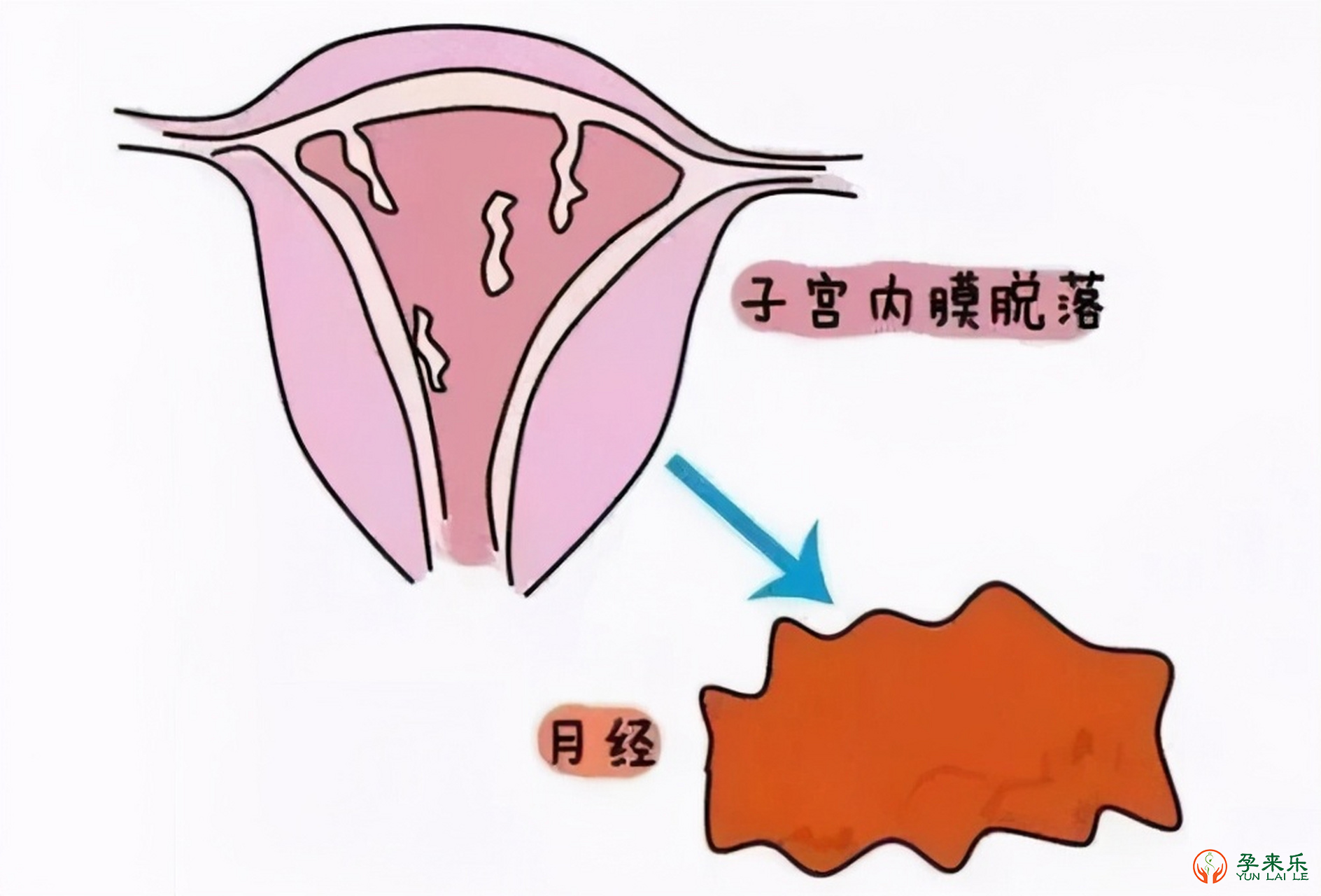 日常如何科学保养内膜？什么状态下的内膜适合试管移植？