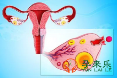 输卵管堵塞等级有几种？输卵管堵塞的治疗方法