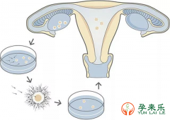 试管婴儿胚胎移植后需要注意些什么？试管移植成功经验分享？