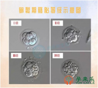 什么情况适合三代试管养囊？三代试管养囊一般要几天？