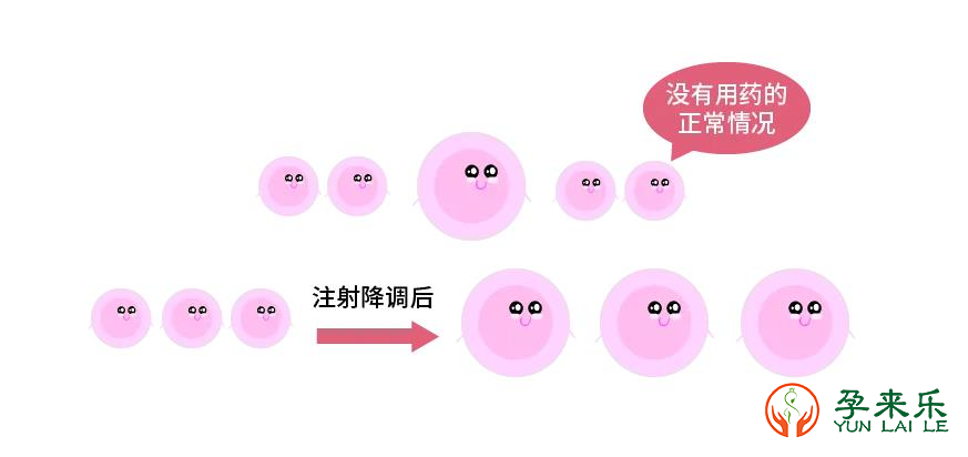 试管婴儿降调是什么?降调节的方案有哪些？