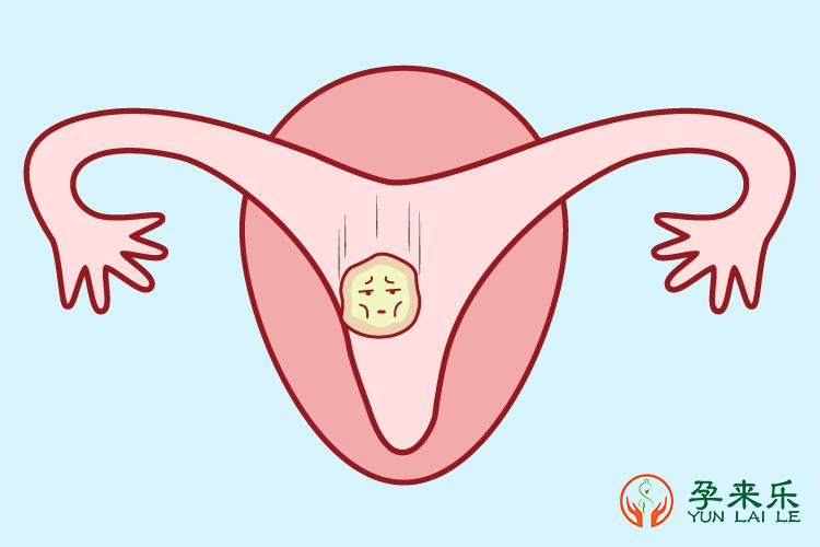 为什么胚胎着床总失败？怎样做移植成功率翻倍？