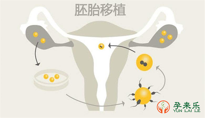 为什么胚胎着床总失败？怎样做移植成功率翻倍？