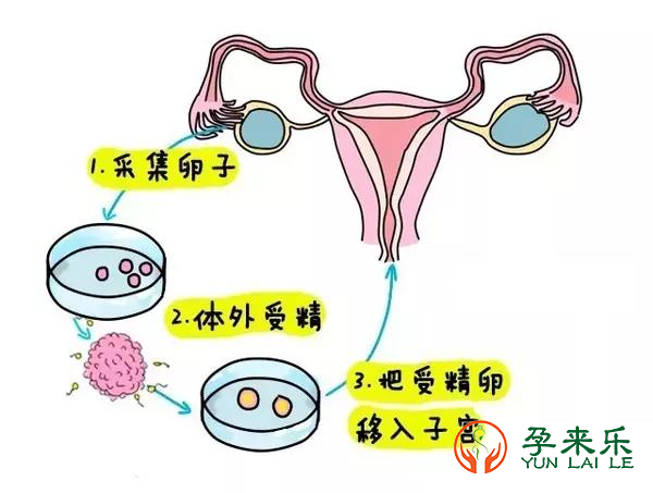 三代试管取卵前应该注意哪些？