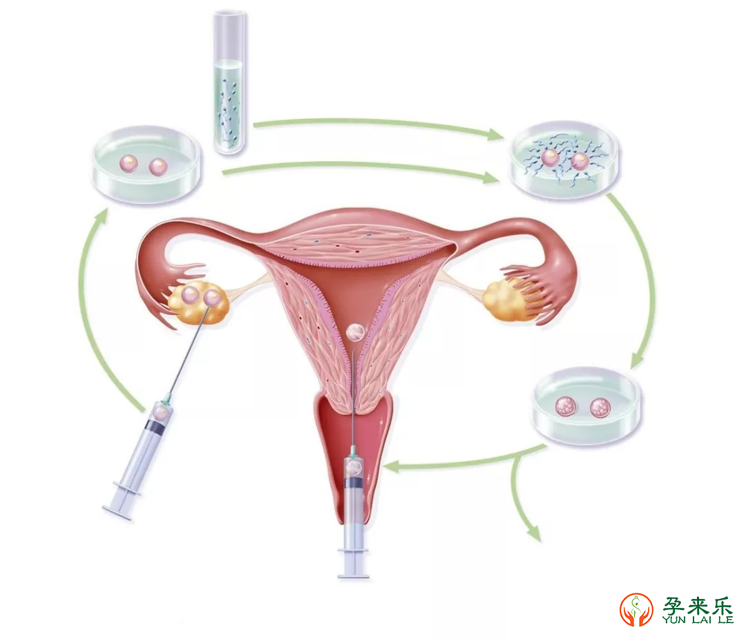 促排卵对女性的伤害有多大？是否会伤害女性身体？