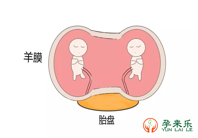 双胎妊娠的风险有哪些？怀上双胞胎要注意什么？