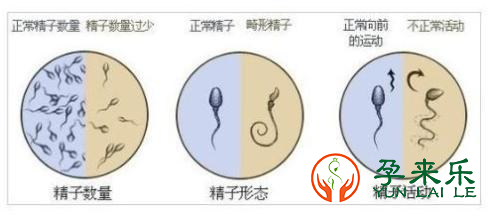 做试管对男性的精子有哪些要求呢？？男性精子质量是否影响试管的成功率？