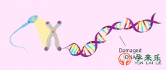 什么是精子DNA碎片？精子DNA碎片率高的原因是什么？