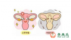 什么是卵巢早衰？卵巢早衰女性可以在国内公立医院选择供L做试管吗