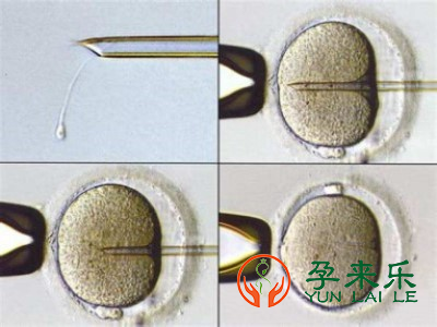 精子液化是什么意思？精子不液化影响做试管婴儿吗？
