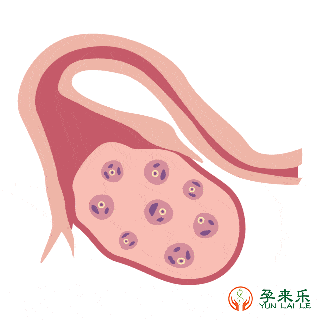 什么是卵巢早衰？卵巢早衰身体会发出哪些信号？